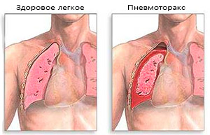 Травма центральной нервной системы8