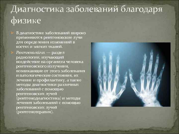 Диагностика заболеваний благодаря физике Ø В диагностике заболеваний широко применяются рентгеновские лучи для определения
