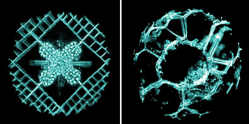 Наружные скелеты радиолярий Lithoptera muelleri, Spongosphaera streptacantha